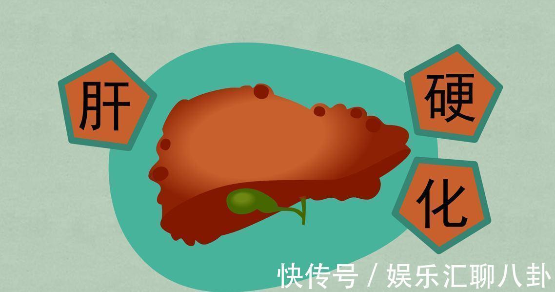 乳酸|早期肝硬化,身体会浮现出“9大症状”,占一半以上,要及时就医