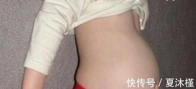 寄生胎|4岁女孩肚子越来越大,医生看到结果后,得知真相父母后悔不已