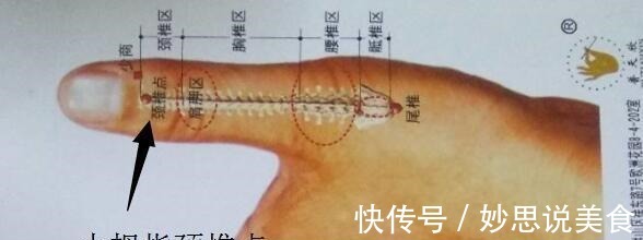 脊髓|花了6万也没治好的颈椎病，被这个小方法治愈了，再也没有复发