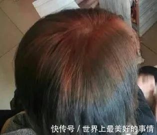人生第一次|千万不要自己在家染发别怪没提醒你,否则后悔都来不及了