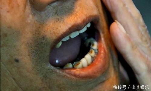 医生|常吃核桃,好处比较多,医生却说:3种人吃了对身体并不好