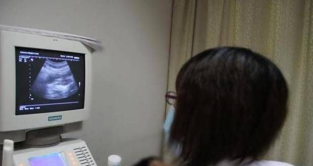 怀孕|怀孕8个月突然来例假,老公急忙送医院,医生检查后连连道喜