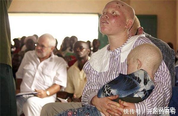 现实版“唐僧”,身处非洲,血液堪比黄金,被警察24小时保护