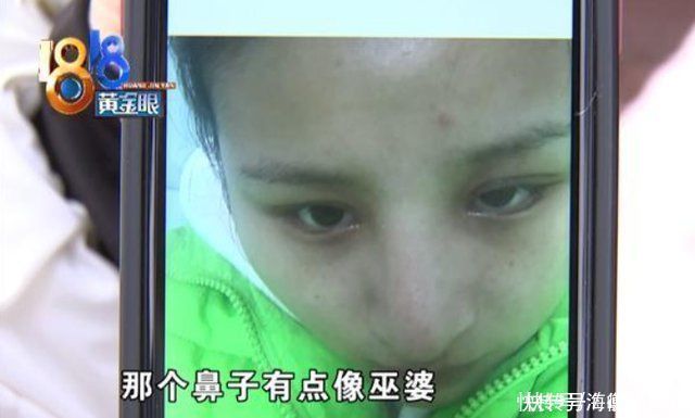 整形手术|女子整容花了6万多,整了个巫婆鼻,女子医生审美有问题