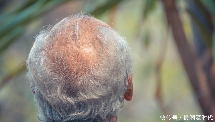 病机|白头发不是随意长的,部位对应着病机,治疗白发中医常用两味药