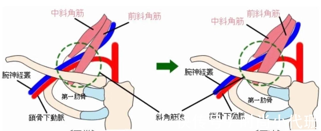 谣言|关于斜方肌的谣言，适可而止吧！