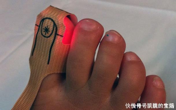 血液循环|肾好的男性,手脚多有4大好现象,你若有1个,说明肾保养的很不错