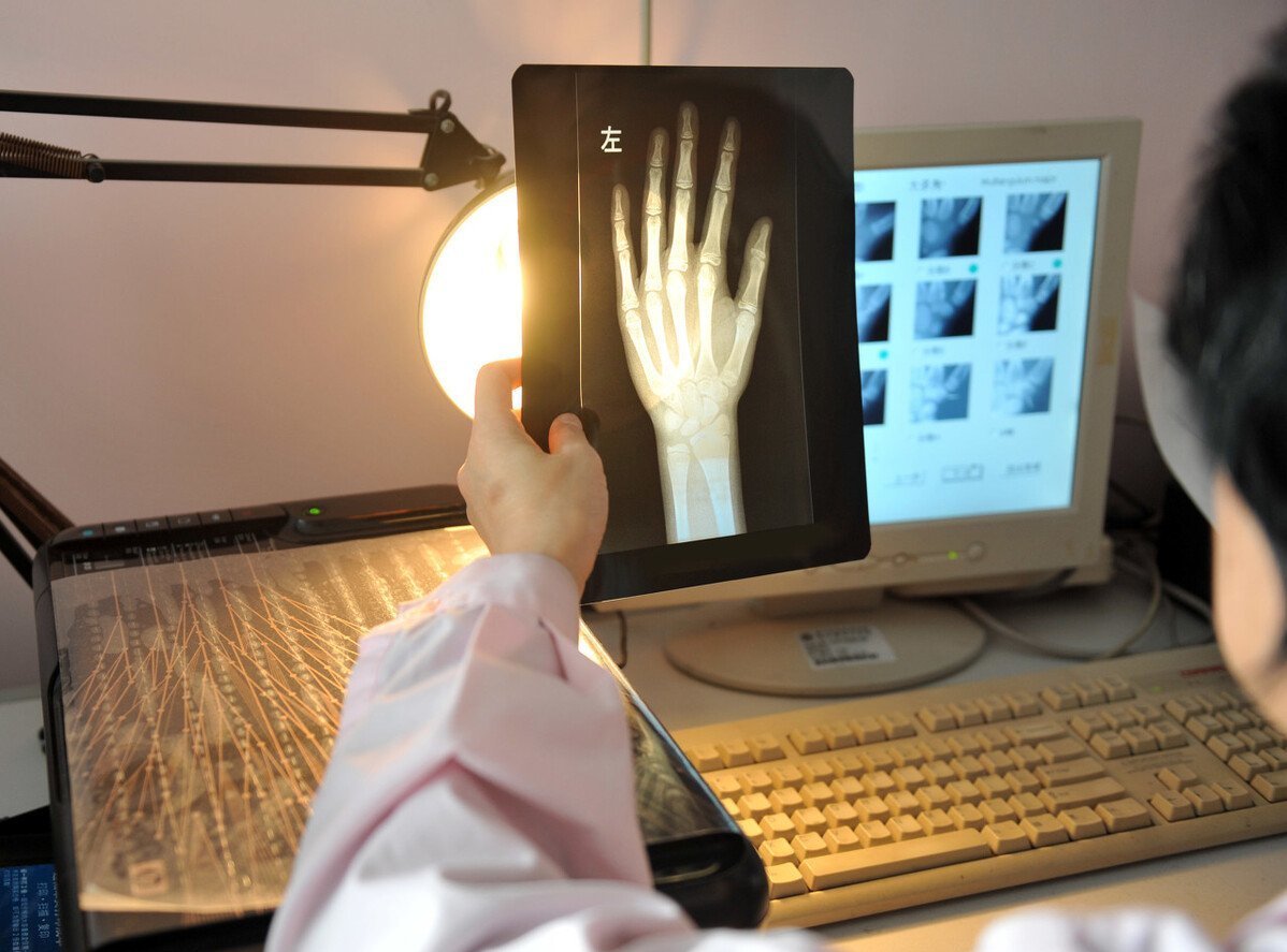 男孩|男孩出现这一改变,暗示进入身高猛涨期,坚持“四提高”帮他长高