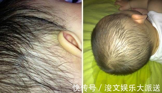 补充水分|宝宝睡觉满头大汗,是热的还是缺钙父母不要忽视出汗几大原因