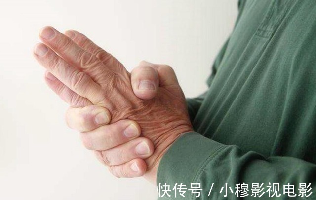 并发症|血脂高的人,多观察手指,若没这几个异常,说明脑梗离你还很远