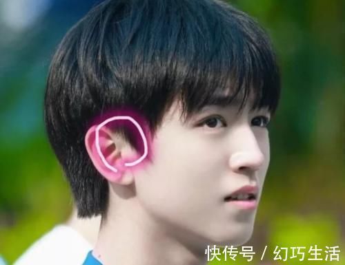 宝妈|为啥有些新生儿耳朵有小孔?医生一般不会主动讲,家长心里要有数