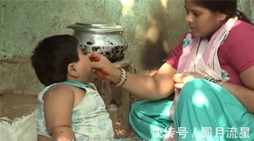 湘雅医学院|印度第一女巨婴:1岁体重45斤,一顿吃2斤米,如今过得怎样