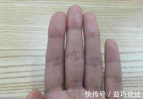 头晕头痛|血管堵,手先知,手上若有这4种表现,可能是血管堵了