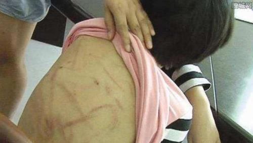 妈妈|7岁女儿半夜发高烧,嘴里却念叨文具盒坏了,妈妈打开后情绪失控