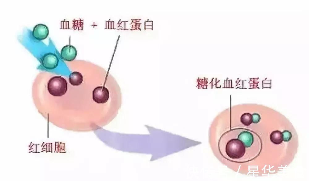 标准|重磅糖尿病降糖标准变了,你必须知道这些