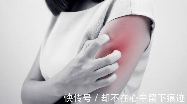 感染|女子身上2处发痒，或子宫已经亮起“红灯”，可能是HPV来了