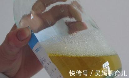 尿蛋白|尿中有泡沫,是肾脏出了问题吗?