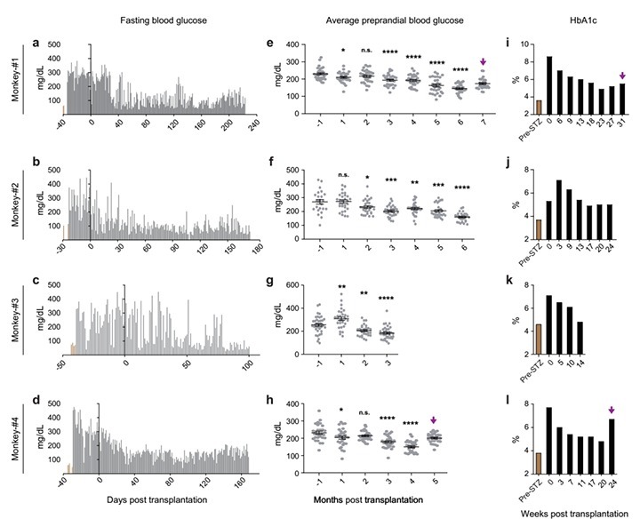 分化|TAA Medical统恩专家告知,糖尿病患者福音来了,干细胞可治疗糖尿病