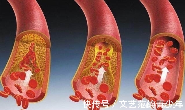 粮食作物|它是高血压的“克星”饭后喝水加一点，稳定血压防三高！