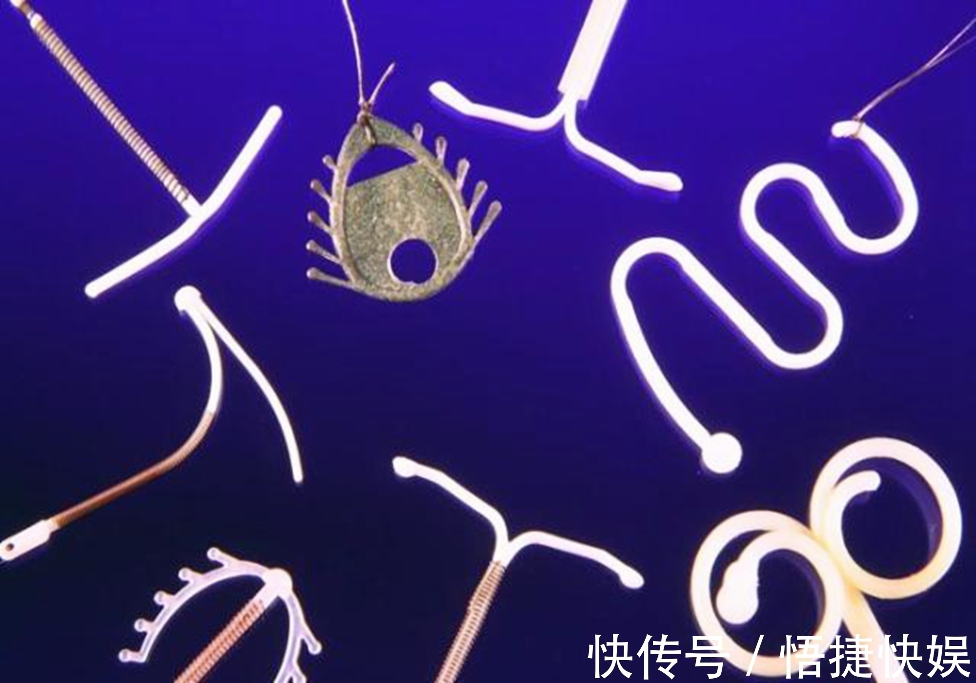 避孕|生一胎后上环,为生二胎取环,医生多亏生二胎的想法救了你