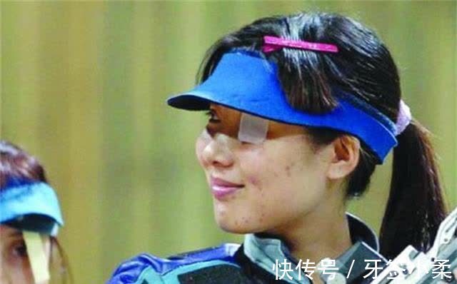 满脸|奥运冠军杜丽:满脸青春痘消失,逆袭成“女神”,39岁风韵犹存