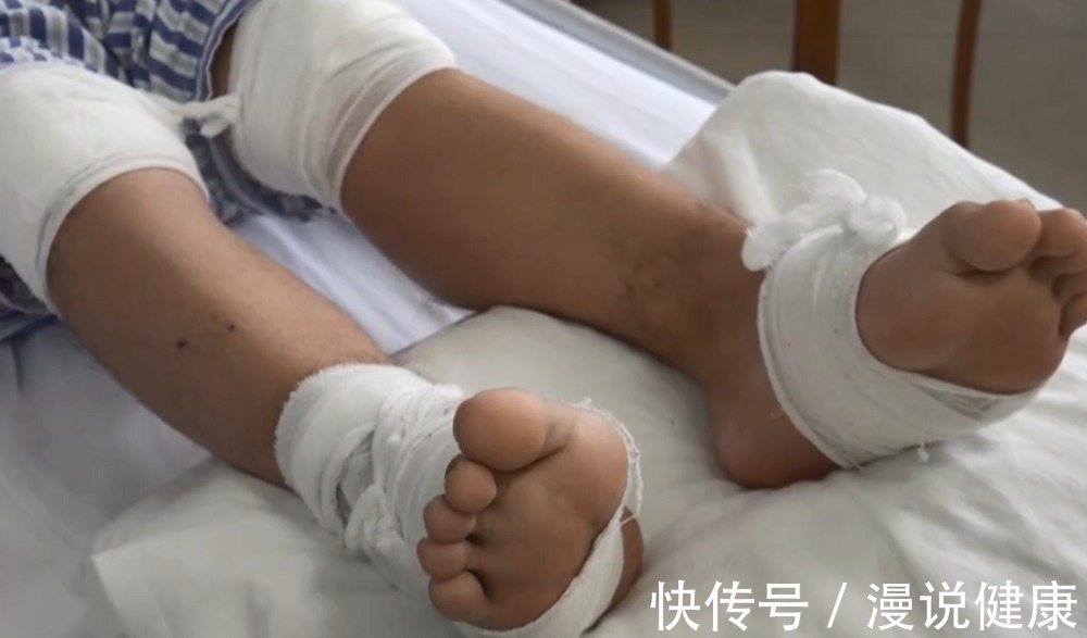 饮食习惯|3年只喝饮料,小伙体内取出23块结石?不想被痛风折磨,做好3件事