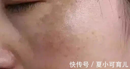 宝妈|二胎宝妈护肤经!孕期坚持以下4种保养方法,助你养出发光肌