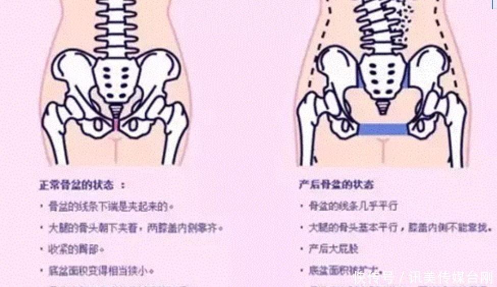 产后|胯部变宽以及顺产的影响有哪些？