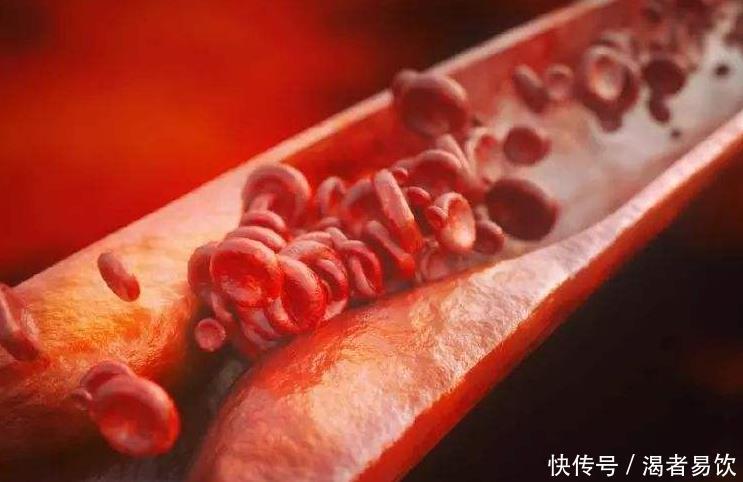 拯救|血管一旦堵塞,身体会发出3个“求救信号”,做好3件事拯救血管