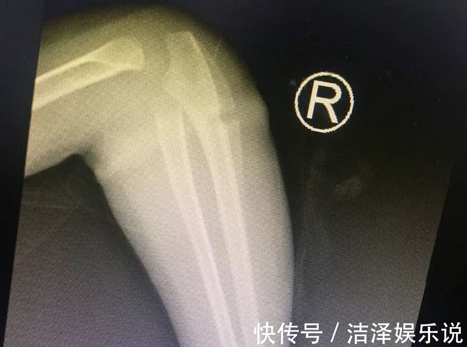 医生|4岁女孩得怪病,医生检查后,忍不住训斥父母心真大