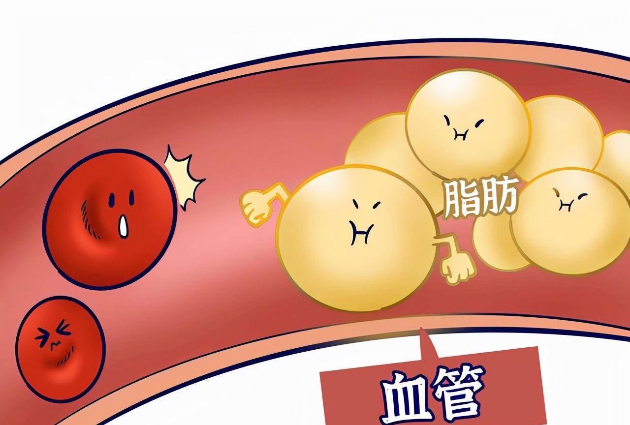 维生素c|多走路可以降血脂?提醒:平时多吃这4种食物,或比走路效果好