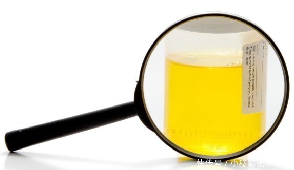 医生|45岁男子,查出肝硬化,医生感叹:身体早有提示,可惜没能重视