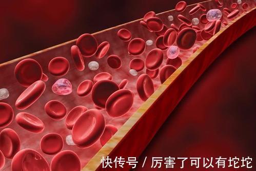 低密度脂蛋白|高血脂有幫兇？醫生提醒：少吃2肉多做3事，堅持1個月勝吃降脂藥
