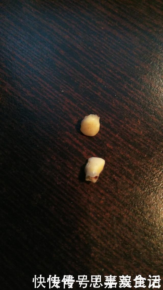 孩子|送给孩子正在换牙的父母们,你们一直都做错了什么?