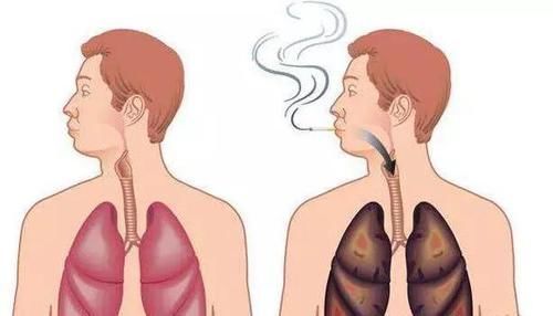 危害|身体每天能承受多少根香烟?医生表示:一天内别超过这个数!