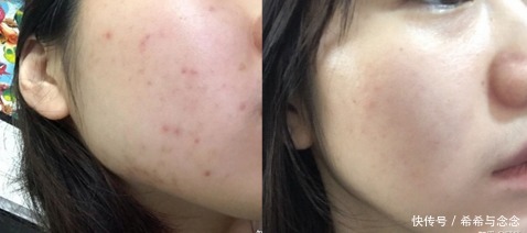 你真的了解孕期护肤真相吗？别让无知毁了脸！科学护肤应该这样做