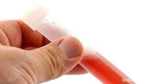 新生儿|这两种血型的女人,第一胎尽量不要流掉,第一个孩子对你很重要