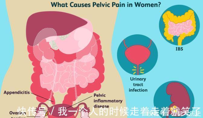 下腹部|关于女性慢性下腹痛,想知道有哪些常见原因吗?医生直接告诉你