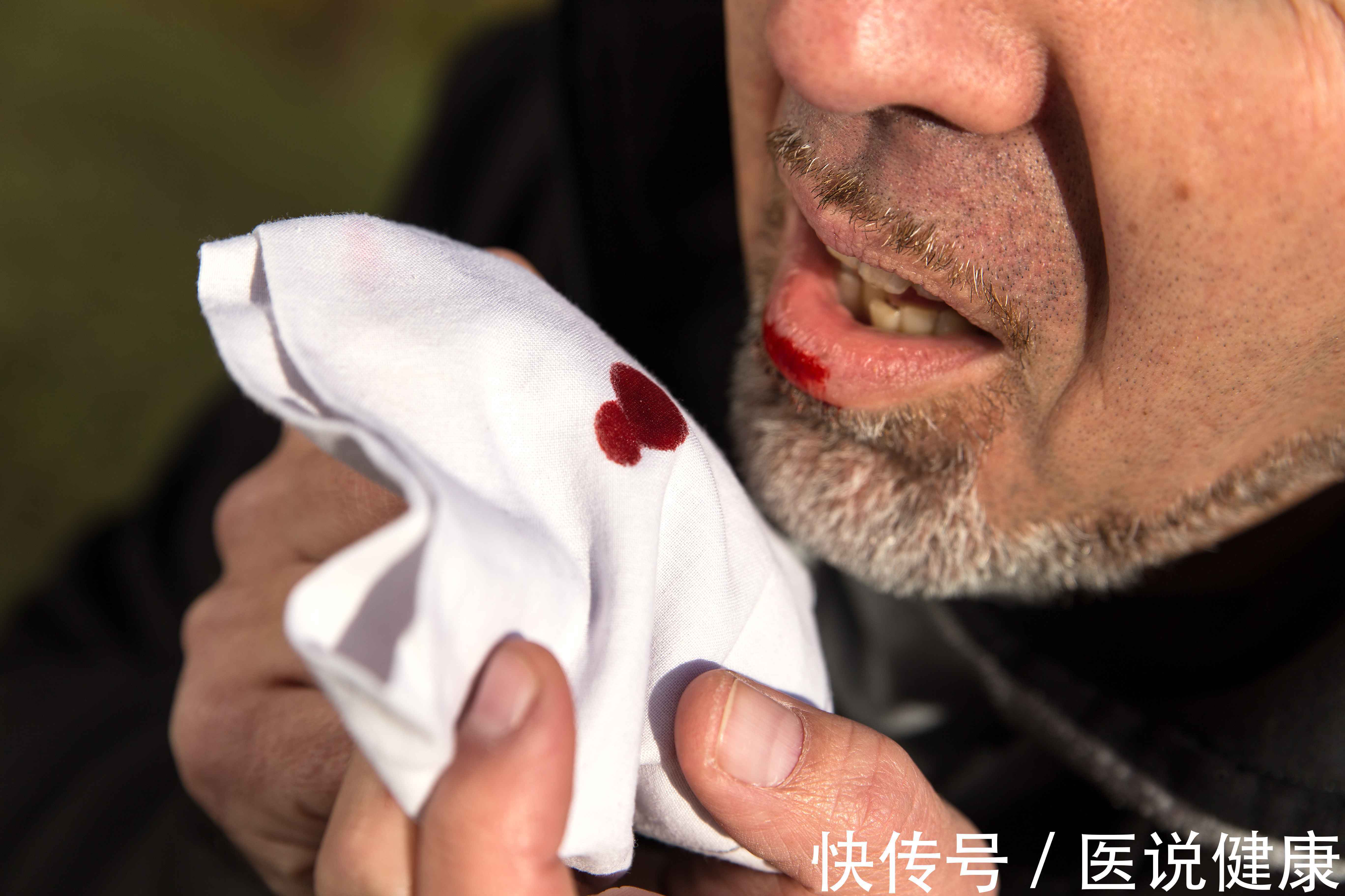 身体|身体经常出现这3个症状,要小心喉癌或找上你了,及时检查