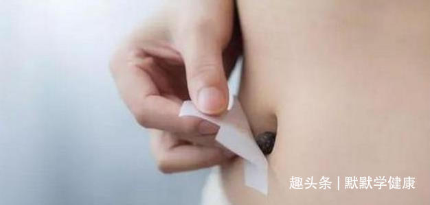 养阳|冬病夏治抓住一年中养阳的40天，阳虚的人记得提前安排好3件事