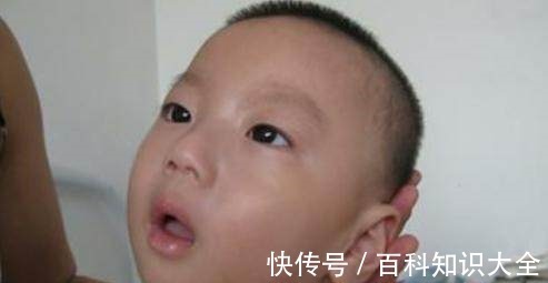 脑瘫儿|新生儿有这几种表现,可能是患上了脑瘫,做父母的不能大意!