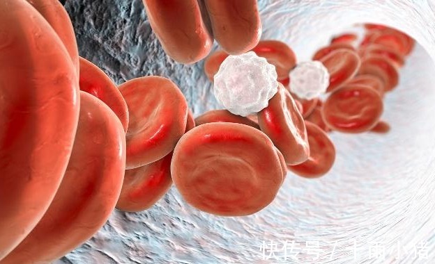 血管|血液粘稠的人,可能有4个症状,若你一个没有,恭喜血管挺干净