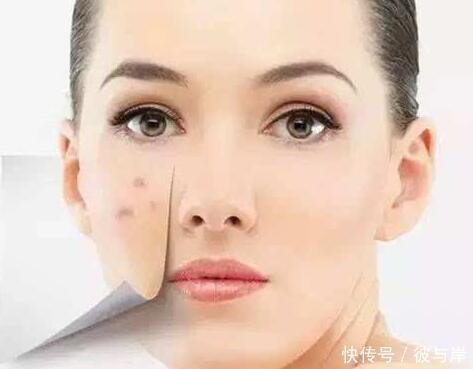 长痘留痘印，大部分与这几点有关！你一定也在其中