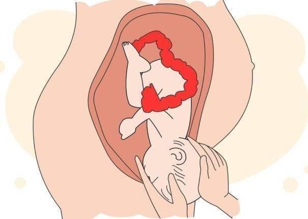 我们来了|顺产分娩时开到几指最疼看看生过孩子的宝妈怎么说