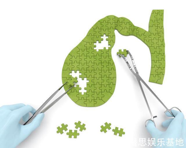 胆结石|胆囊切除有何后遗症?这3种“结局”不好受,除非万不得已,别切