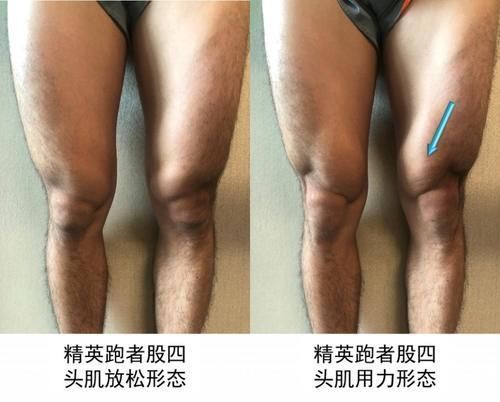 训练|坚持跑步给你留下训练痕迹了吗？跑者的十大形态特征