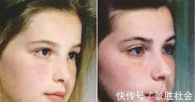 儿子|儿子越长越像“大猩猩”，宝妈调侃长残了，朋友提醒才去医院检查