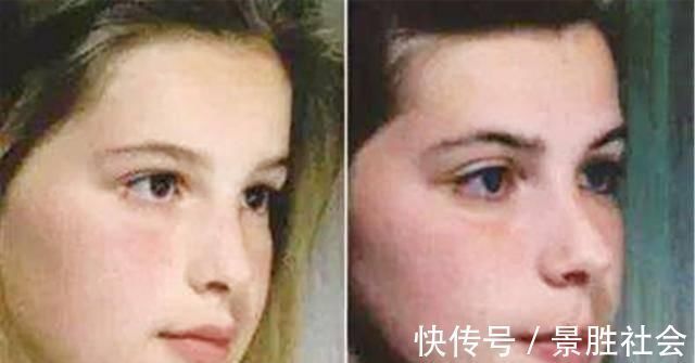 儿子|儿子越长越像“大猩猩”,宝妈调侃长残了,朋友提醒才去医院检查