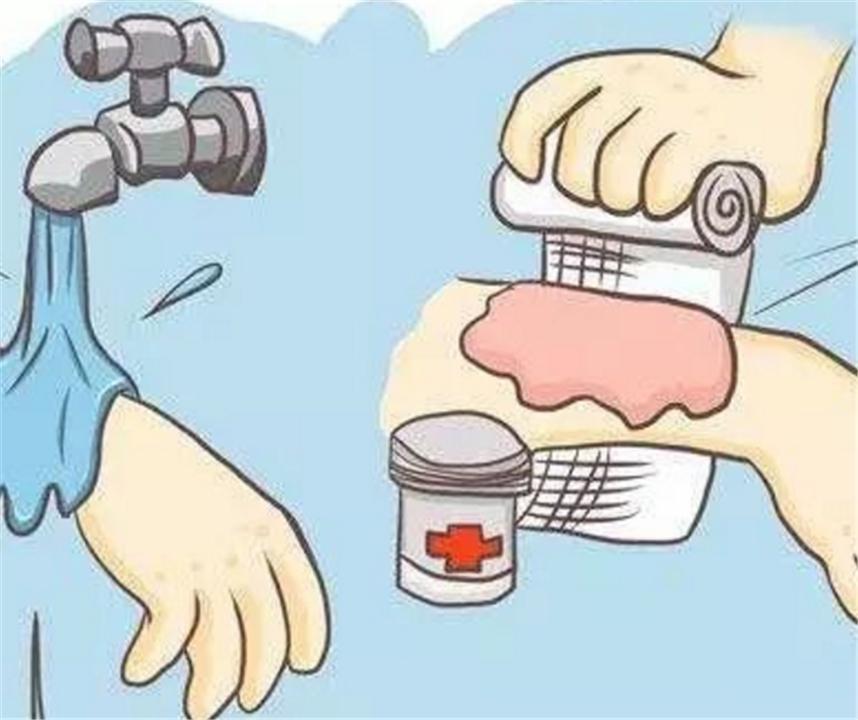 泡面|儿子被开水烫伤,爸爸无心之举却救了娃,医生竖起大拇指很专业