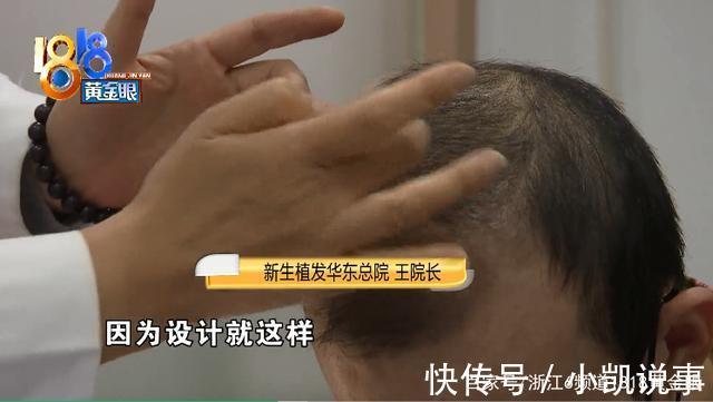 植发 植发两年急转直下 质疑“拆东墙补西墙”